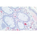 Immunohistochemistry - Anti-CDX2 Antibody (A83711) - Antibodies.com