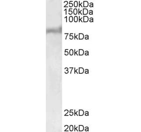 Western Blot - Anti-ABCD2 Antibody (A83712) - Antibodies.com