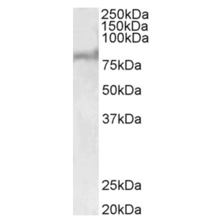 Western Blot - Anti-ABCD2 Antibody (A83712) - Antibodies.com