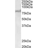 Western Blot - Anti-ABCD2 Antibody (A83712) - Antibodies.com