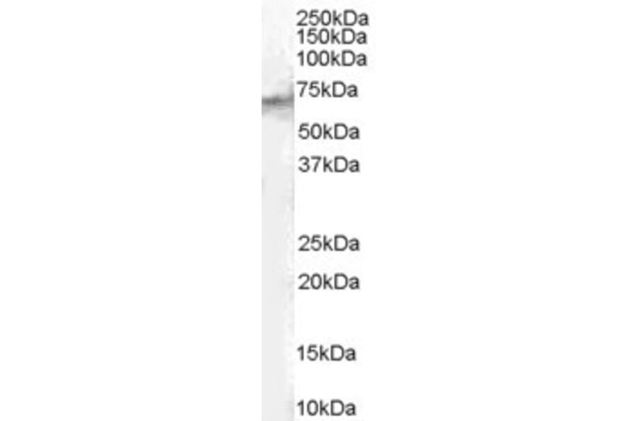 Western Blot - Anti-STAM2 Antibody (A83713) - Antibodies.com