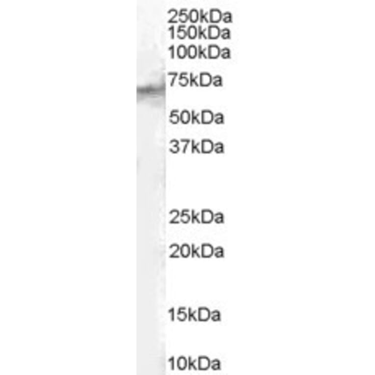 Western Blot - Anti-STAM2 Antibody (A83713) - Antibodies.com