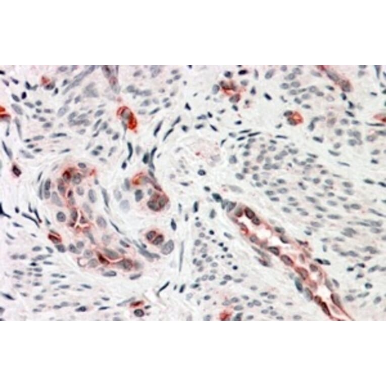 Immunohistochemistry - Anti-DKK3 Antibody (A83714) - Antibodies.com