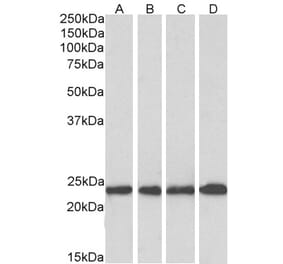 Western Blot - Anti-SOD2/MnSOD Antibody (A83715) - Antibodies.com