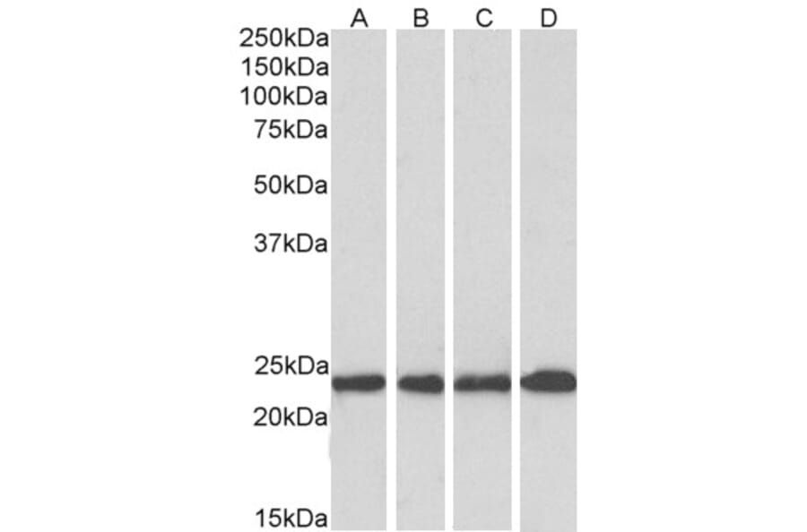 Western Blot - Anti-SOD2/MnSOD Antibody (A83715) - Antibodies.com
