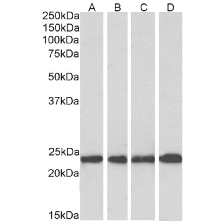 Western Blot - Anti-SOD2/MnSOD Antibody (A83715) - Antibodies.com