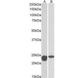 Western Blot - Anti-SOD2 Antibody (A83715) - Antibodies.com