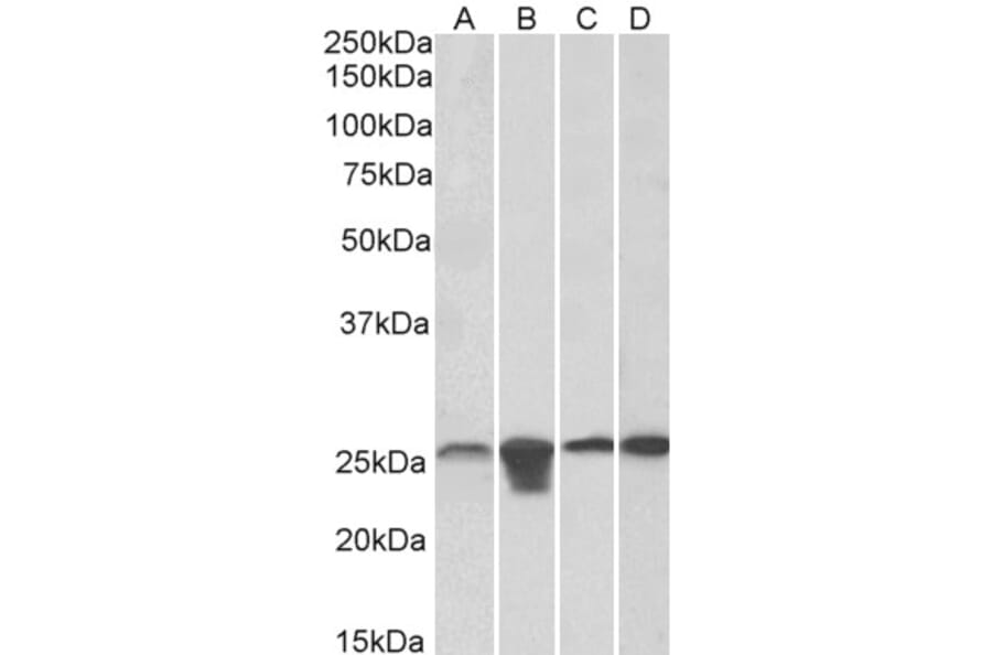 Western Blot - Anti-SOD2/MnSOD Antibody (A83715) - Antibodies.com