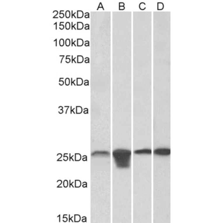 Western Blot - Anti-SOD2/MnSOD Antibody (A83715) - Antibodies.com