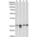 Western Blot - Anti-SOD2/MnSOD Antibody (A83715) - Antibodies.com