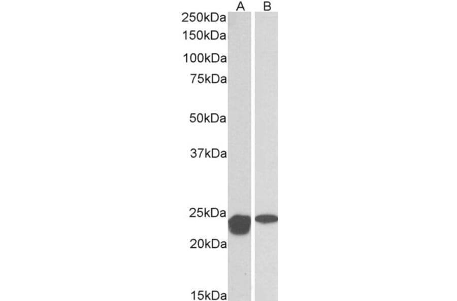 Western Blot - Anti-SOD2/MnSOD Antibody (A83715) - Antibodies.com