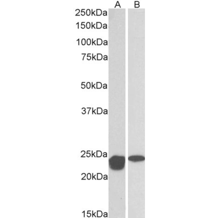 Western Blot - Anti-SOD2/MnSOD Antibody (A83715) - Antibodies.com