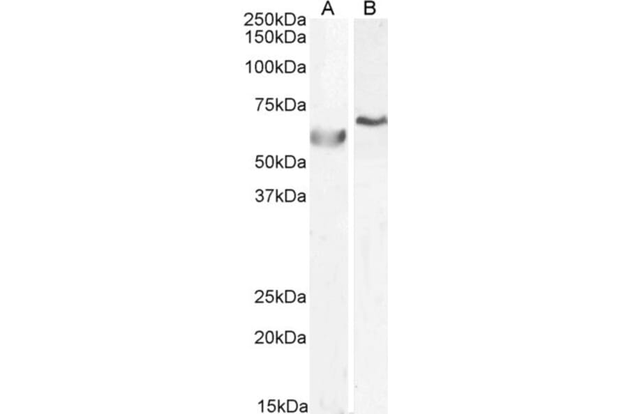 Western Blot - Anti-DNA Polymerase lambda/Polk Antibody (A83716) - Antibodies.com