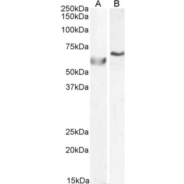 Western Blot - Anti-DNA Polymerase lambda/Polk Antibody (A83716) - Antibodies.com