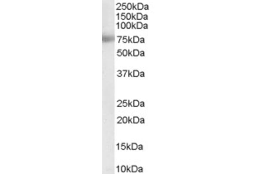 Western Blot - Anti-MTA1 Antibody (A83718) - Antibodies.com
