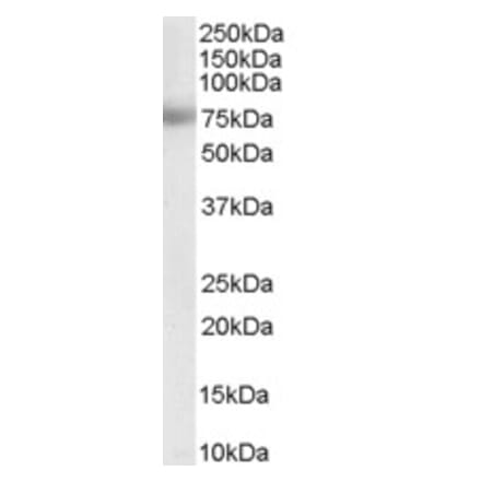 Western Blot - Anti-MTA1 Antibody (A83718) - Antibodies.com