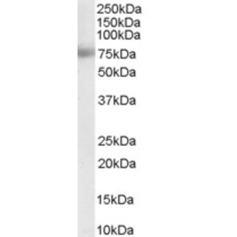 Western Blot - Anti-MTA1 Antibody (A83718) - Antibodies.com