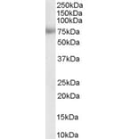 Western Blot - Anti-MTA1 Antibody (A83718) - Antibodies.com