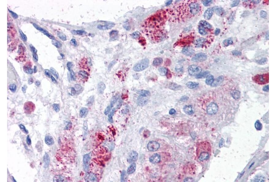 Immunohistochemistry - Anti-MTA1 Antibody (A83718) - Antibodies.com