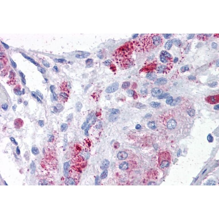 Immunohistochemistry - Anti-MTA1 Antibody (A83718) - Antibodies.com