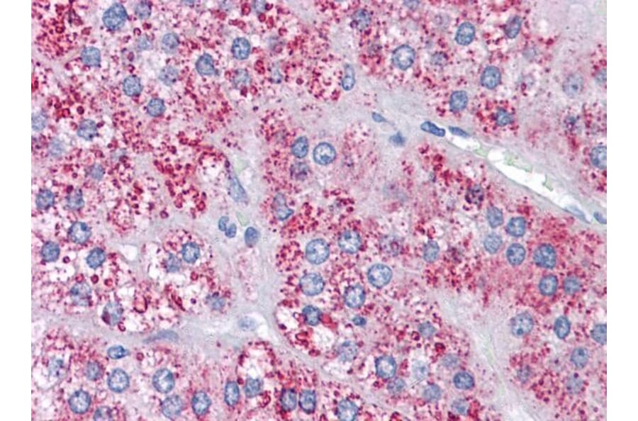 Immunohistochemistry - Anti-MTA1 Antibody (A83718) - Antibodies.com