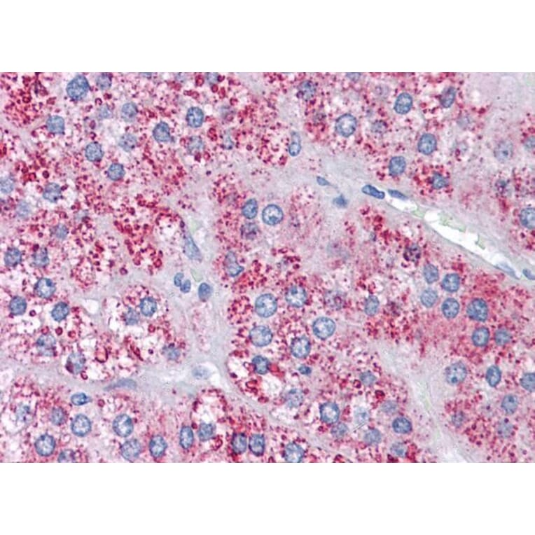 Immunohistochemistry - Anti-MTA1 Antibody (A83718) - Antibodies.com