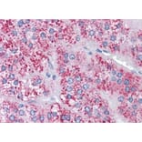 Immunohistochemistry - Anti-MTA1 Antibody (A83718) - Antibodies.com