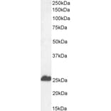 Western Blot - Anti-Calbindin Antibody (A83719) - Antibodies.com