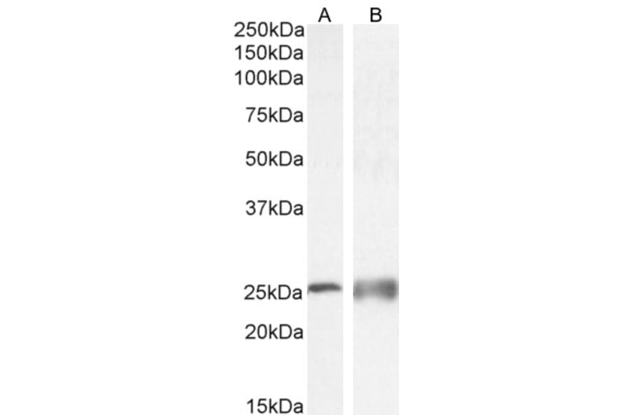 Western Blot - Anti-Calbindin Antibody (A83719) - Antibodies.com