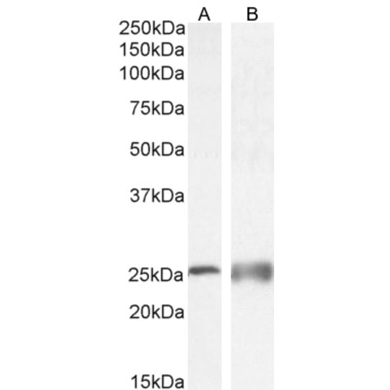 Western Blot - Anti-Calbindin Antibody (A83719) - Antibodies.com