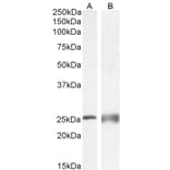 Western Blot - Anti-Calbindin Antibody (A83719) - Antibodies.com