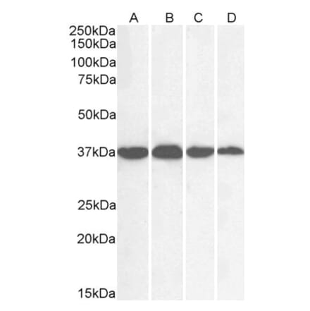 Western Blot - Anti-GAPDH Antibody (A83722)