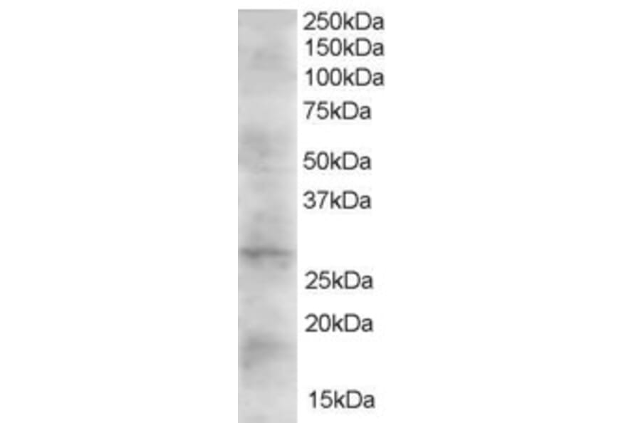 Western Blot - Anti-DKK2 Antibody (A83724) - Antibodies.com