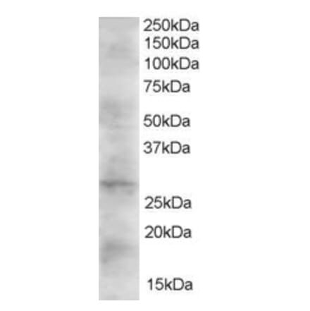 Western Blot - Anti-DKK2 Antibody (A83724) - Antibodies.com