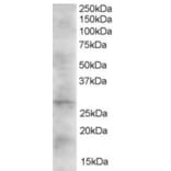 Western Blot - Anti-DKK2 Antibody (A83724) - Antibodies.com