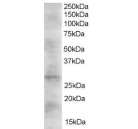 Western Blot - Anti-DKK2 Antibody (A83724) - Antibodies.com