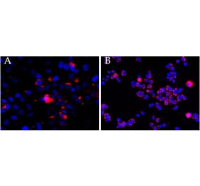 Immunofluorescence - Anti-CEP290 Antibody (A83725) - Antibodies.com