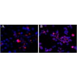 Immunocytochemistry - Anti-CEP290 Antibody (A83725) - Antibodies.com