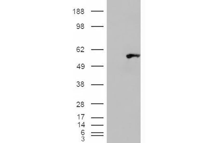 Western Blot - Anti-WIPF1 Antibody (A83726) - Antibodies.com