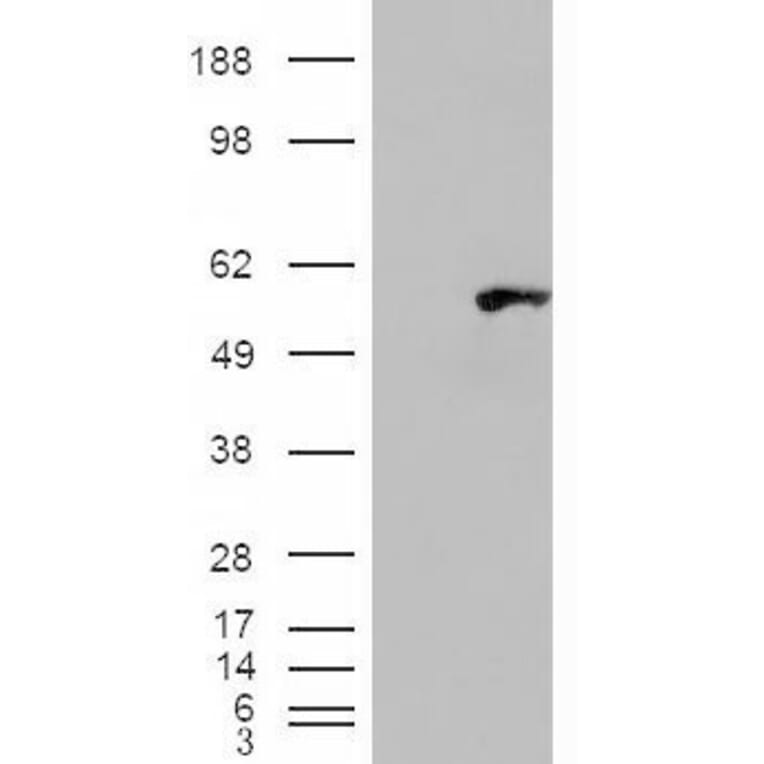 Western Blot - Anti-WIPF1 Antibody (A83726) - Antibodies.com