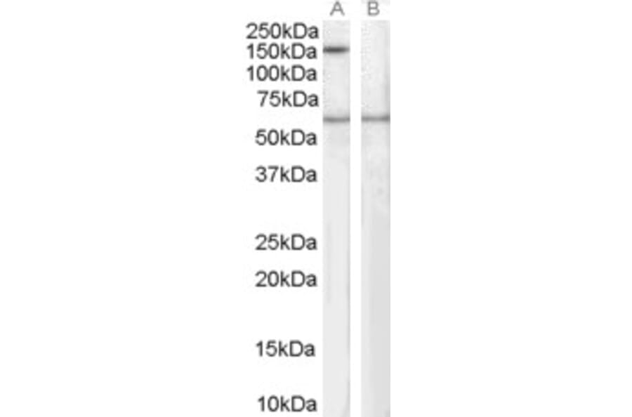 Western Blot - Anti-Spa-1 Antibody (A83727) - Antibodies.com
