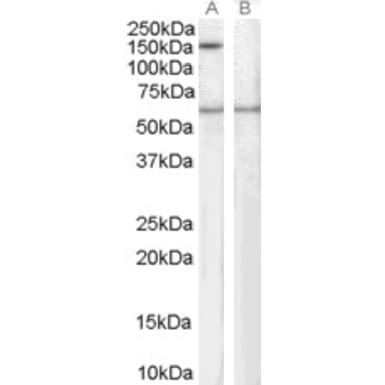 Western Blot - Anti-Spa-1 Antibody (A83727) - Antibodies.com