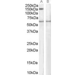 Western Blot - Anti-Spa-1 Antibody (A83727) - Antibodies.com