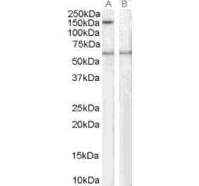 Western Blot - Anti-SIPA1 Antibody (A83727) - Antibodies.com
