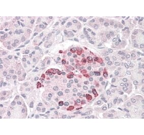 Immunohistochemistry - Anti-SOCS4 Antibody (A83728) - Antibodies.com