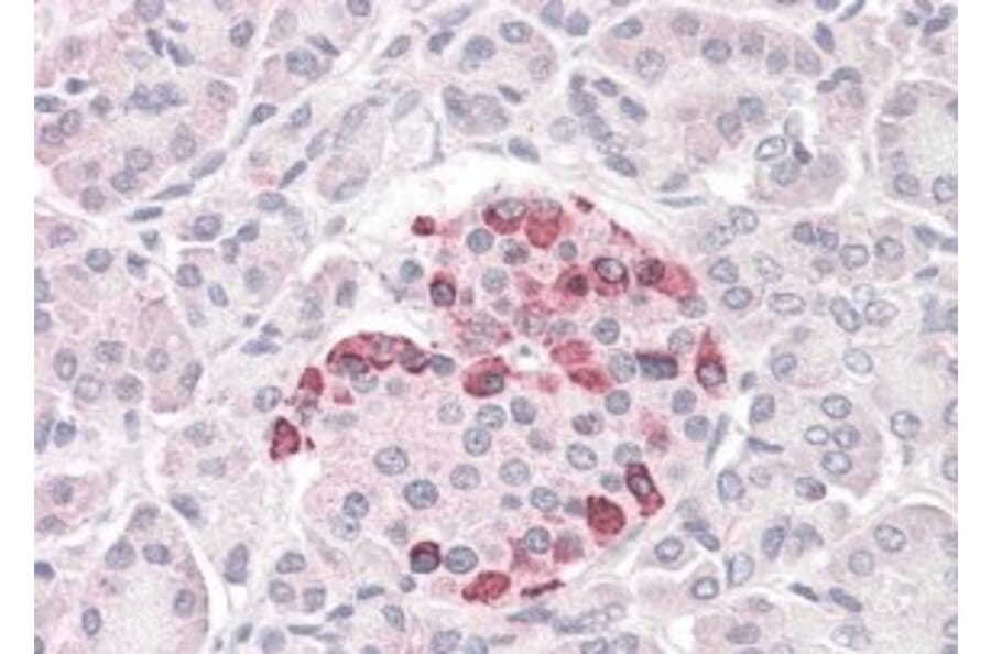 Immunohistochemistry - Anti-SOCS4 Antibody (A83728) - Antibodies.com