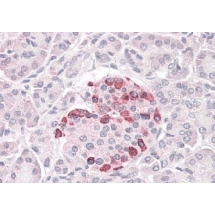 Immunohistochemistry - Anti-SOCS4 Antibody (A83728) - Antibodies.com
