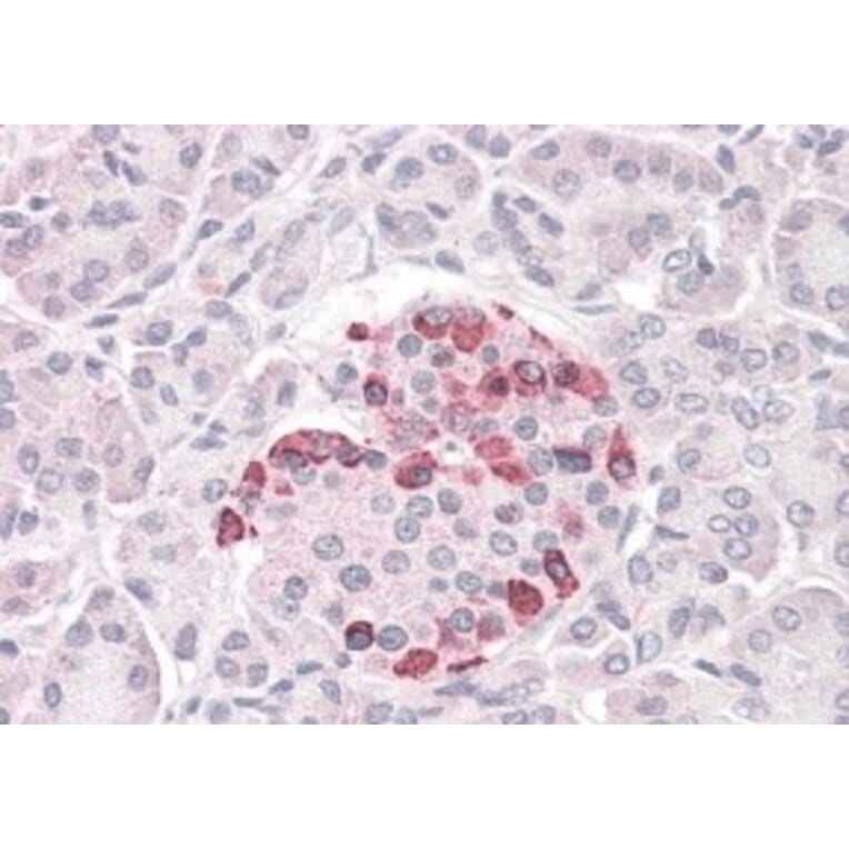 Immunohistochemistry - Anti-SOCS4 Antibody (A83728) - Antibodies.com