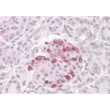Immunohistochemistry - Anti-SOCS4 Antibody (A83728) - Antibodies.com