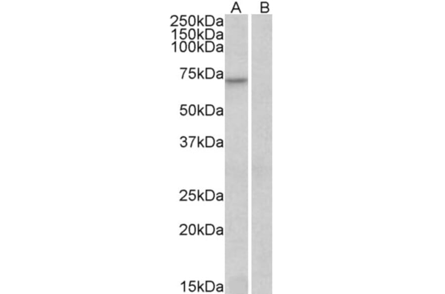 Western Blot - Anti-FOXO3A Antibody (A83729) - Antibodies.com